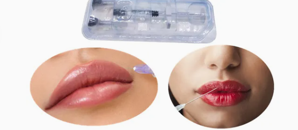 hyaluronic acid lip fillers hyaluronic acid lip fillers